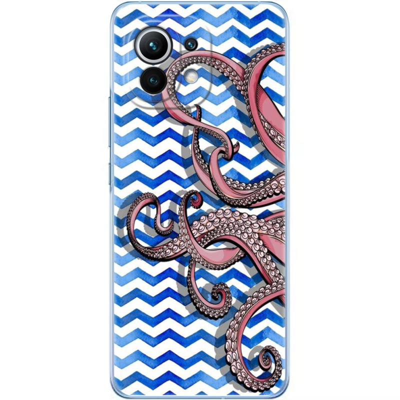 Чехол BoxFace Xiaomi Mi 11 Sea Tentacles