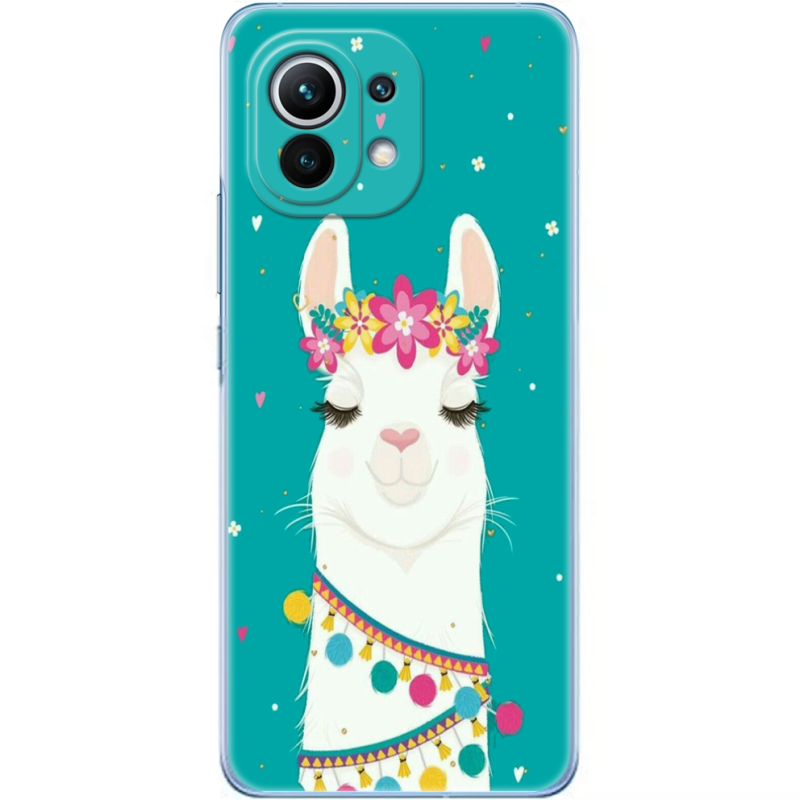 Чехол BoxFace Xiaomi Mi 11 Cold Llama