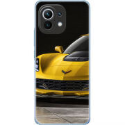 Чехол BoxFace Xiaomi Mi 11 Corvette Z06