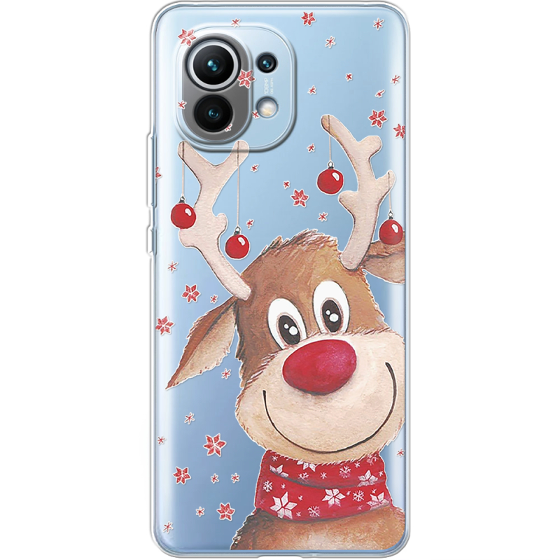 Прозрачный чехол BoxFace Xiaomi Mi 11 Winter Deer