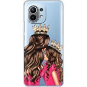 Прозрачный чехол BoxFace Xiaomi Mi 11 Queen and Princess