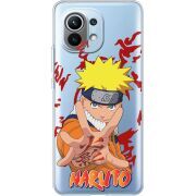 Прозрачный чехол BoxFace Xiaomi Mi 11 Naruto