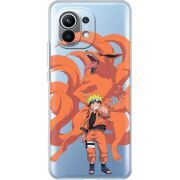 Прозрачный чехол BoxFace Xiaomi Mi 11 Naruto and Kurama