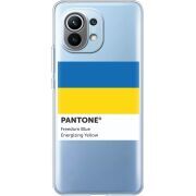 Прозрачный чехол BoxFace Xiaomi Mi 11 Pantone вільний синій