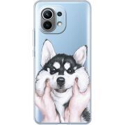 Прозрачный чехол BoxFace Xiaomi Mi 11 Husky