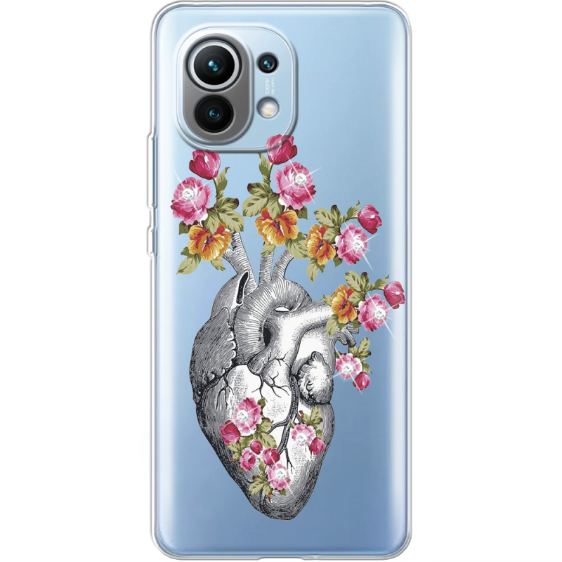 Чехол со стразами Xiaomi Mi 11 Heart