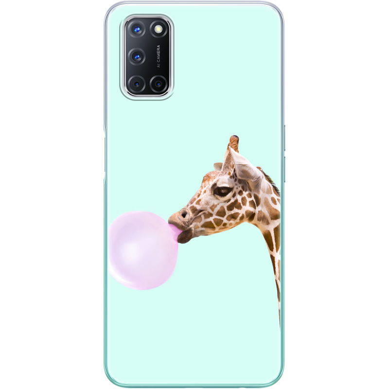 Чехол BoxFace OPPO A72/ A52 