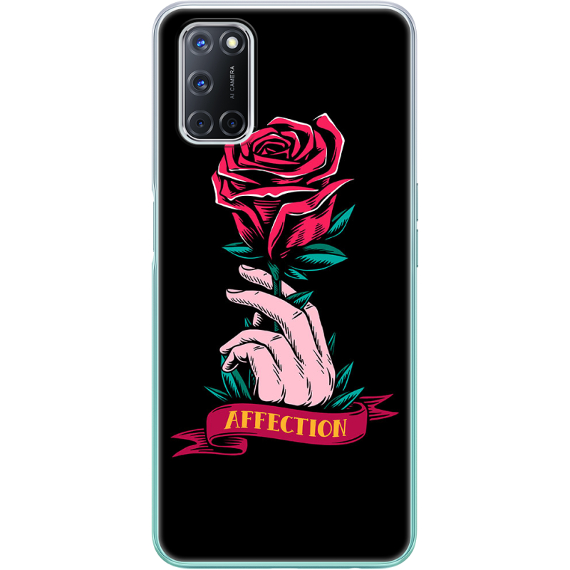 Чехол BoxFace OPPO A72/ A52 