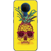 Чехол BoxFace Nokia 5.4 Pineapple Skull