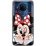 Прозрачный чехол BoxFace Nokia 5.4 Lady M