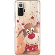 Прозрачный чехол BoxFace Xiaomi Redmi Note 10 Pro Winter Deer