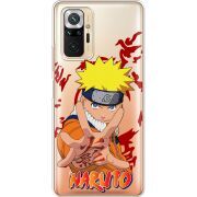 Прозрачный чехол BoxFace Xiaomi Redmi Note 10 Pro Naruto