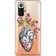 Чехол со стразами Xiaomi Redmi Note 10 Pro Heart