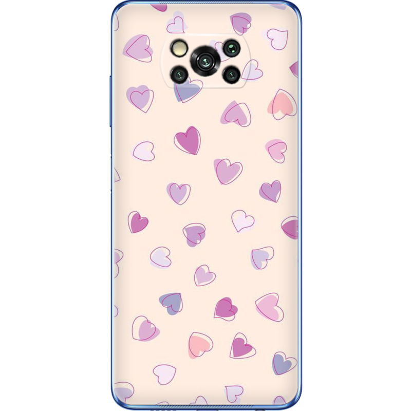 Чехол BoxFace Poco X3 Pro 