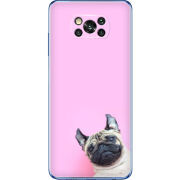 Чехол BoxFace Poco X3 Pro 