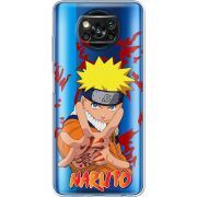 Прозрачный чехол BoxFace Xiaomi Poco X3 Pro Naruto