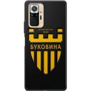 Черный чехол BoxFace Xiaomi Redmi Note 10 Pro 