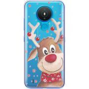 Прозрачный чехол BoxFace Nokia 1.4 Winter Deer