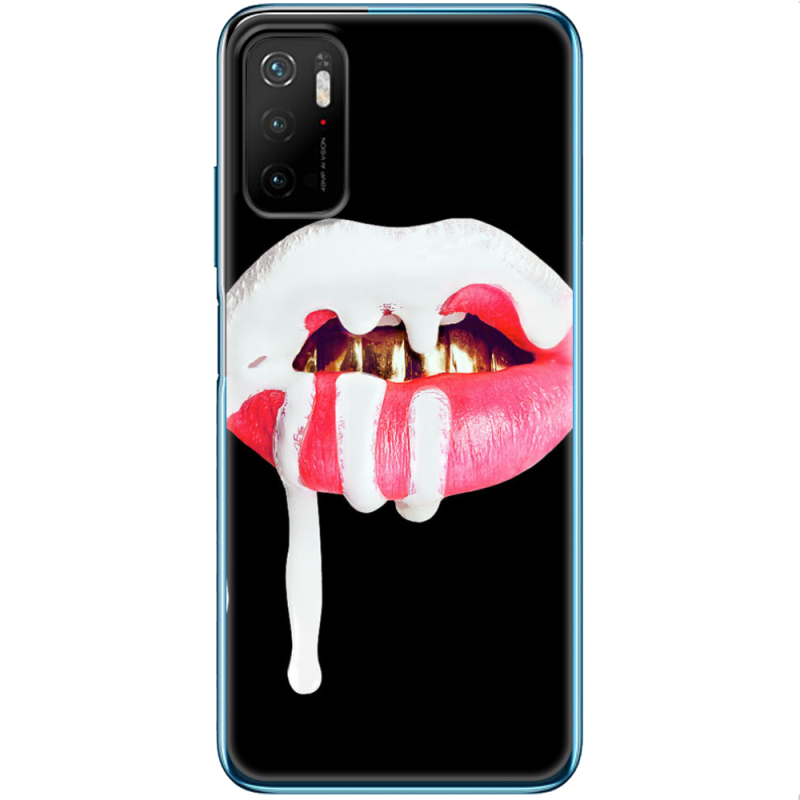 Чехол BoxFace Xiaomi Poco M3 Pro 