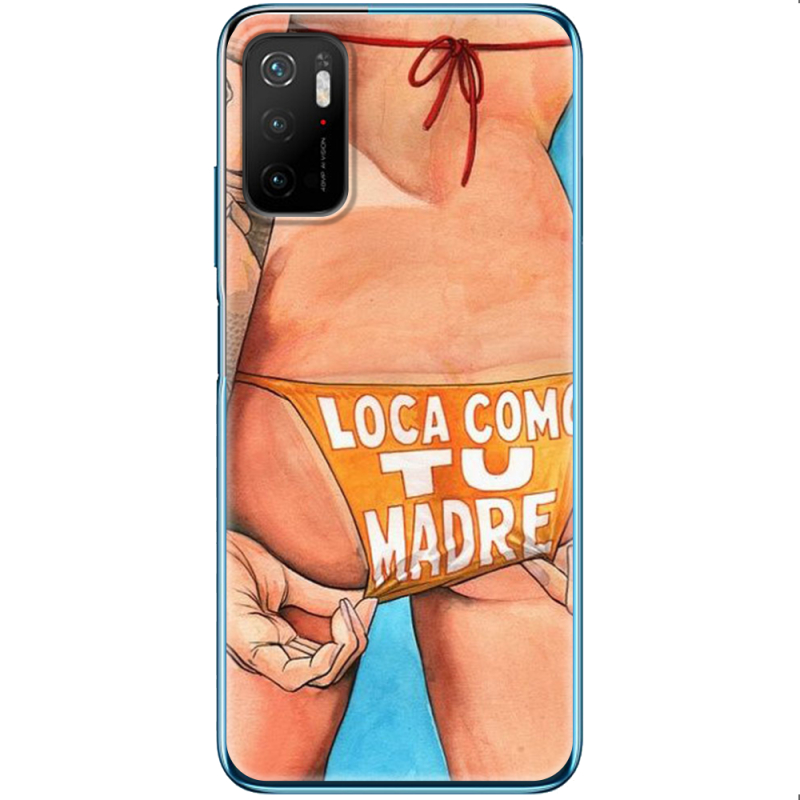 Чехол BoxFace Xiaomi Poco M3 Pro 