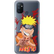 Прозрачный чехол BoxFace OnePlus Nord N100 Naruto