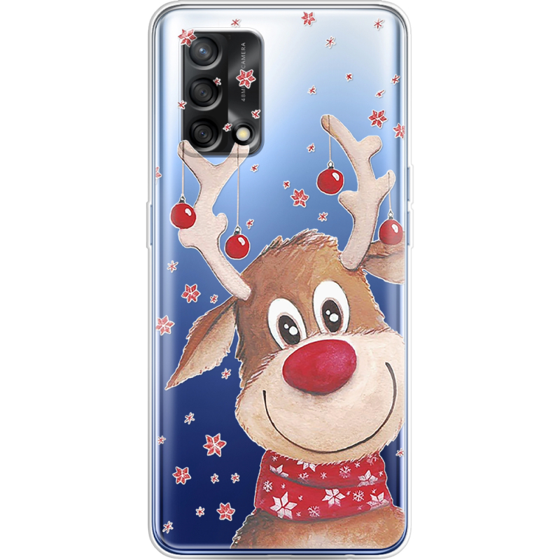 Прозрачный чехол BoxFace OPPO A74 Winter Deer