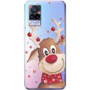 Прозрачный чехол Uprint Vivo V21 Winter Deer