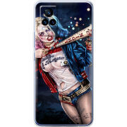 Чехол Uprint Vivo V21E Harley Quinn