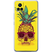 Чехол Uprint Vivo V21E Pineapple Skull