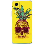 Чехол BoxFace Vivo Y31 Pineapple Skull