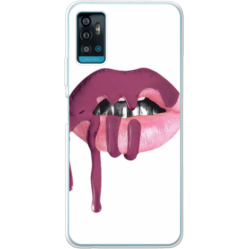 Чехол BoxFace ZTE Blade A71 