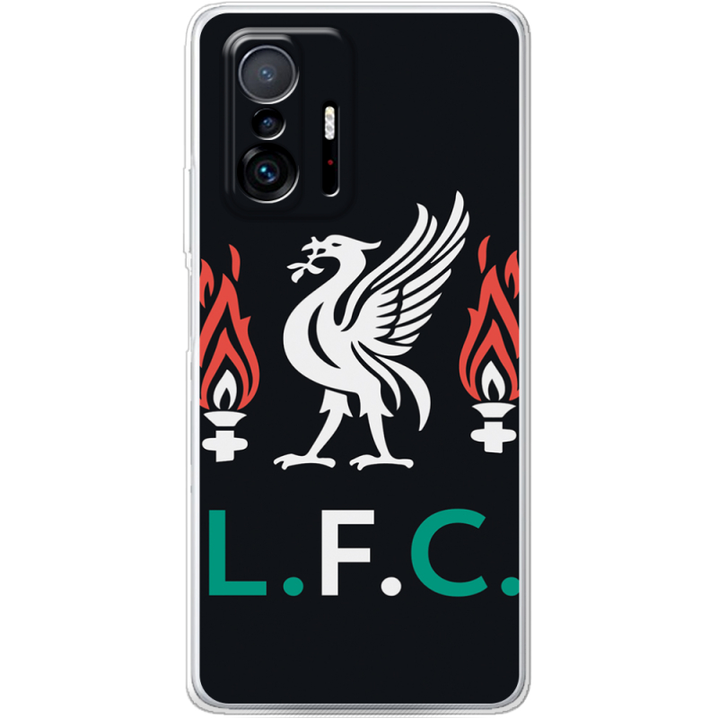 Чехол BoxFace Xiaomi 11T / 11T Pro L. F. C.