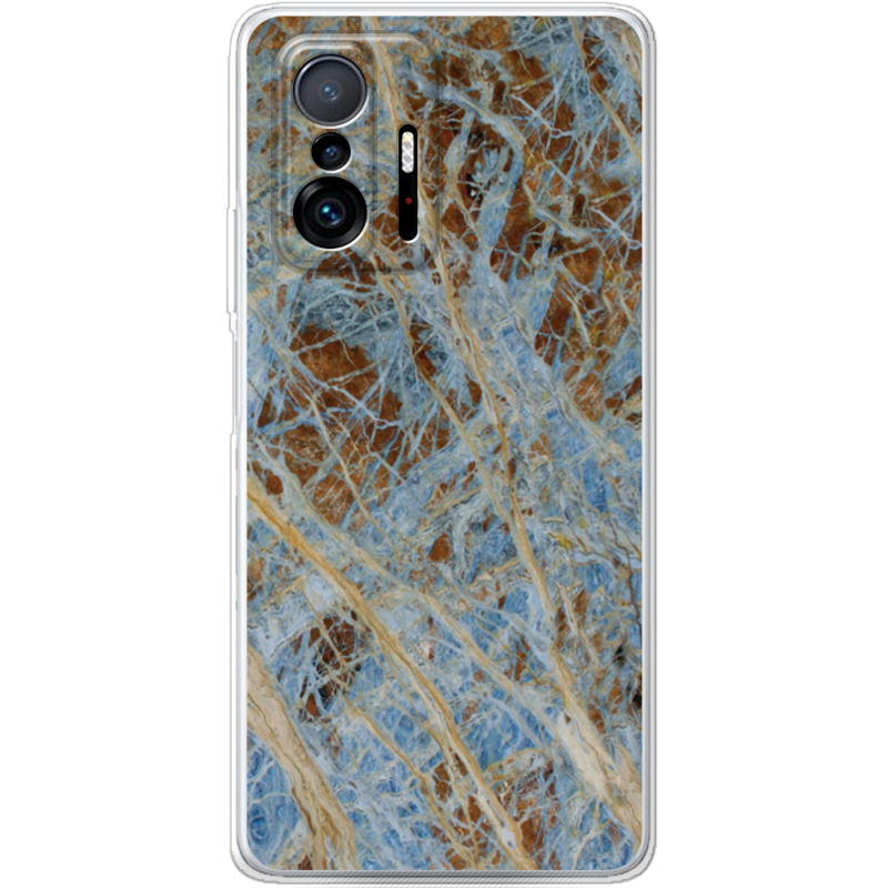 Чехол BoxFace Xiaomi 11T / 11T Pro 