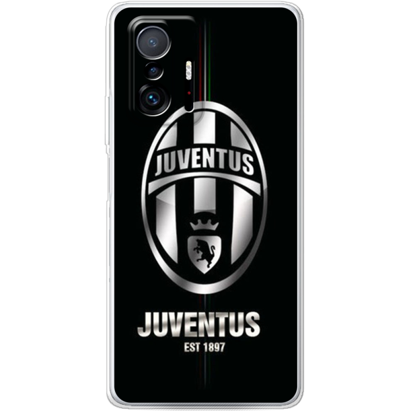 Чехол BoxFace Xiaomi 11T / 11T Pro 