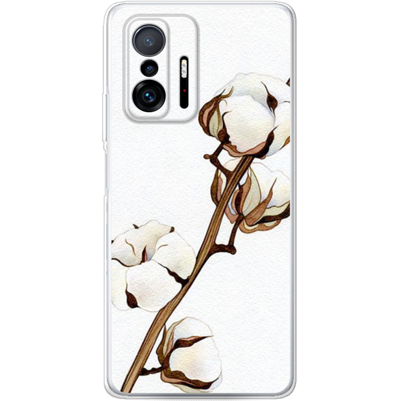 Чехол BoxFace Xiaomi 11T / 11T Pro 