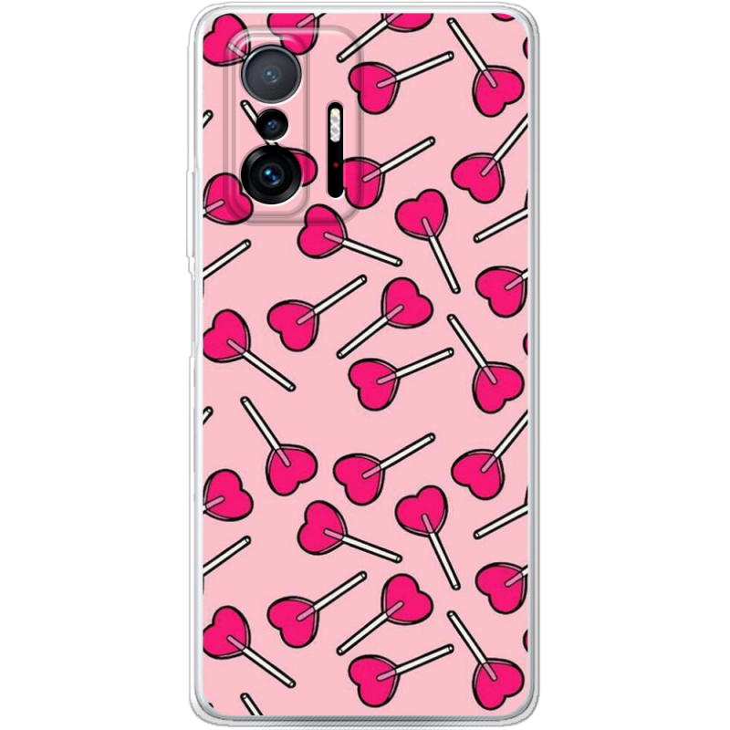 Чехол BoxFace Xiaomi 11T / 11T Pro 