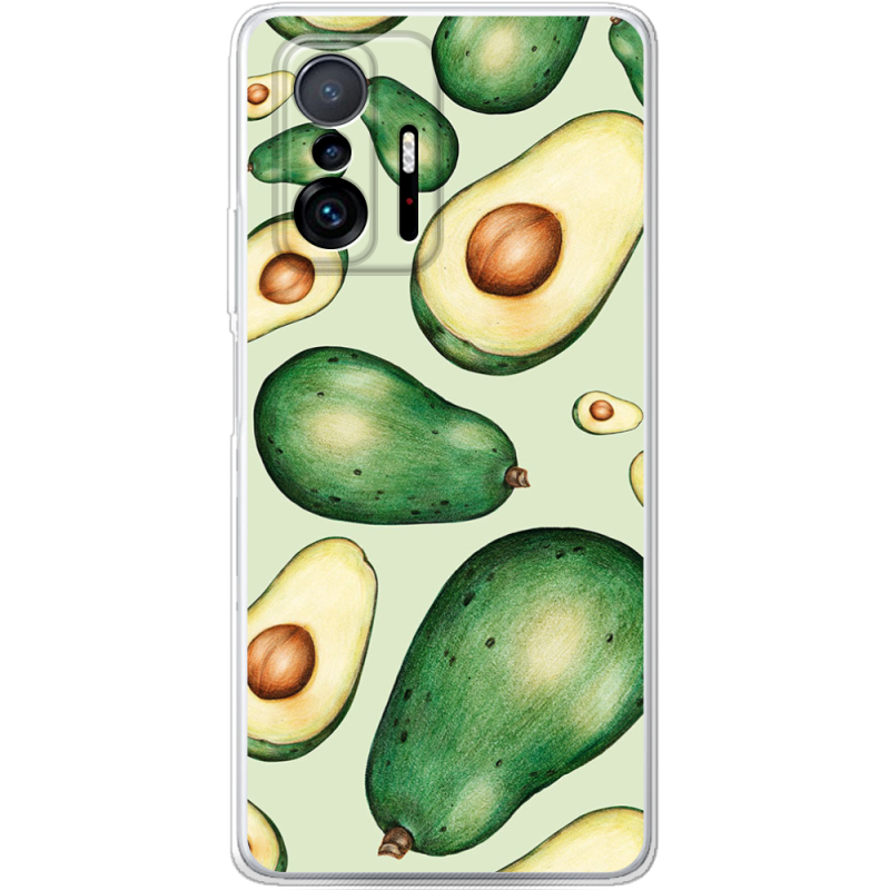 Чехол BoxFace Xiaomi 11T / 11T Pro 