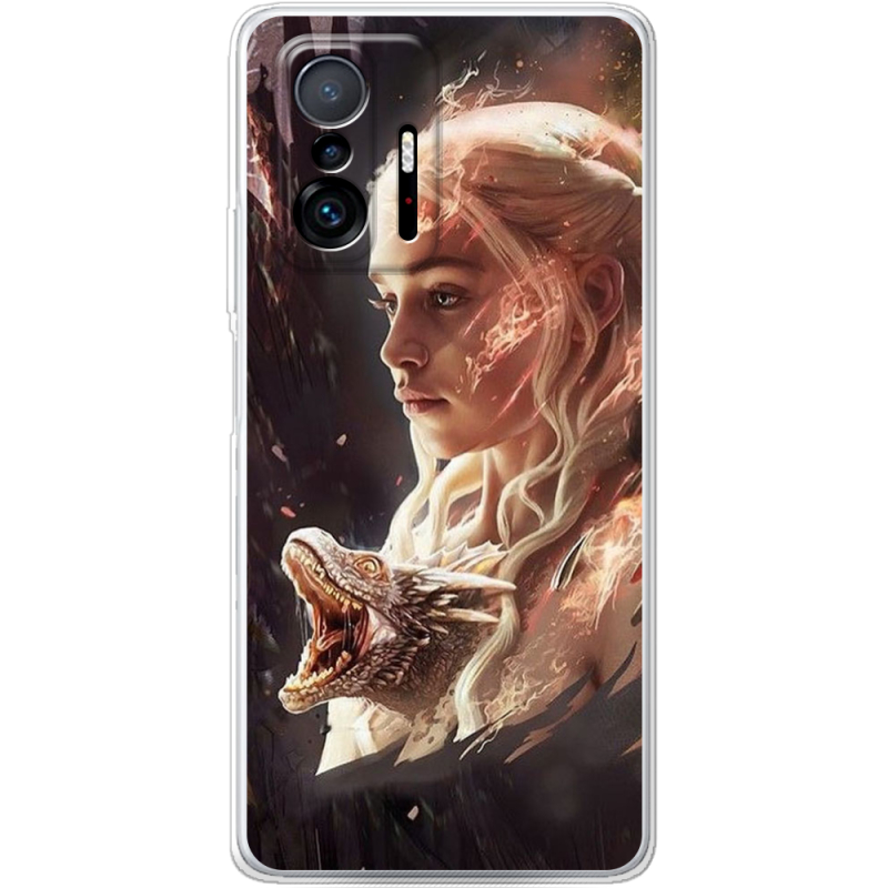 Чехол BoxFace Xiaomi 11T / 11T Pro 