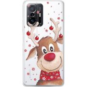 Прозрачный чехол BoxFace Xiaomi 11T / 11T Pro Winter Deer