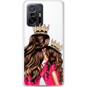 Прозрачный чехол BoxFace Xiaomi 11T / 11T Pro Queen and Princess