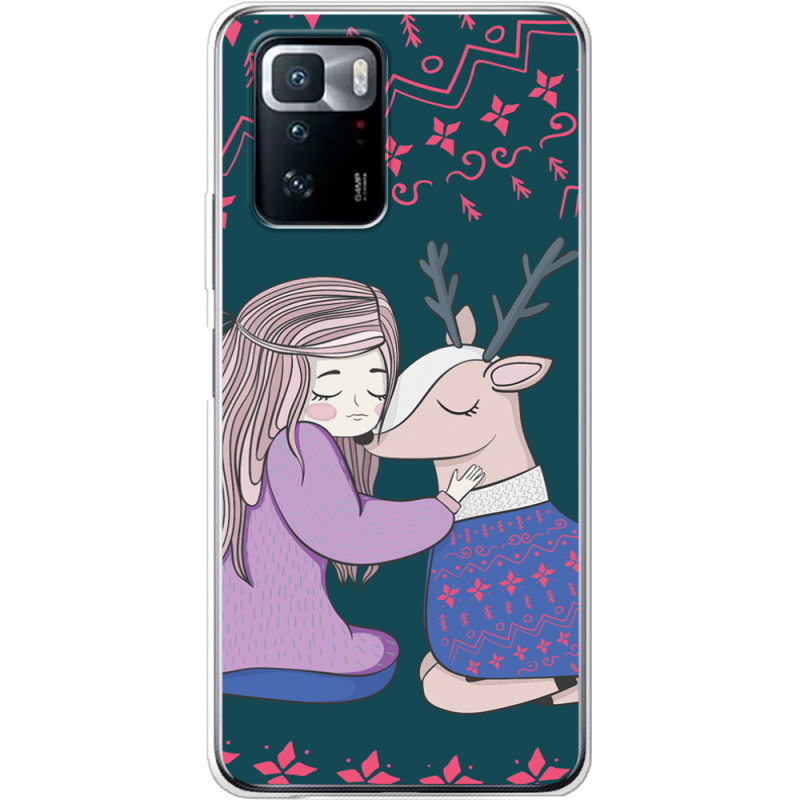 Чехол BoxFace Xiaomi Poco X3 GT Girl and deer