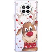 Прозрачный чехол BoxFace Huawei Nova 8i Winter Deer