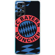 Чехол BoxFace Xiaomi Poco M4 Pro 5G FC Bayern