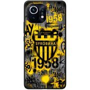 Черный чехол BoxFace Xiaomi Mi 11 