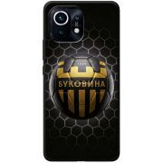 Черный чехол BoxFace Xiaomi Mi 11 