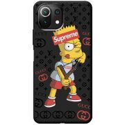 Черный чехол BoxFace Xiaomi Mi 11 Lite Yellow Fun