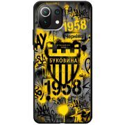 Черный чехол BoxFace Xiaomi Mi 11 Lite 