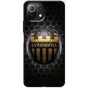 Черный чехол BoxFace Xiaomi Mi 11 Lite 
