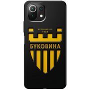 Черный чехол BoxFace Xiaomi Mi 11 Lite 