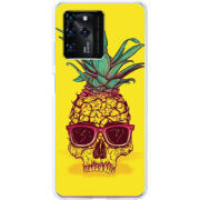 Чехол BoxFace ZTE Blade V30 Pineapple Skull